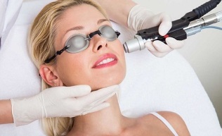 как се извършва процедурата за лазерно подмладяване на кожата на лицето 