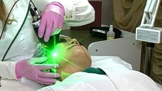 плюсове и минуси на лазерното подмладяване на кожата на лицето